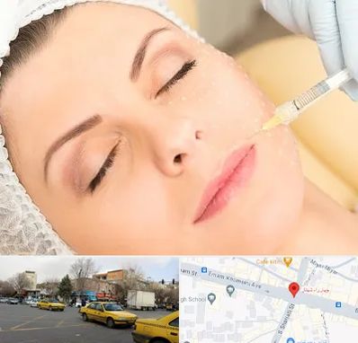 کلینیک تزریق چربی در شهناز تبریز