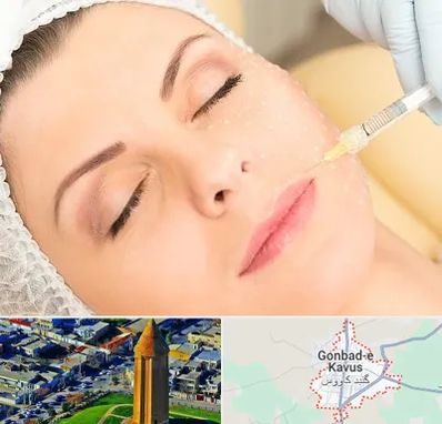کلینیک تزریق چربی در گنبد کاووس