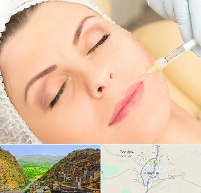 کلینیک تزریق چربی در کامیاران