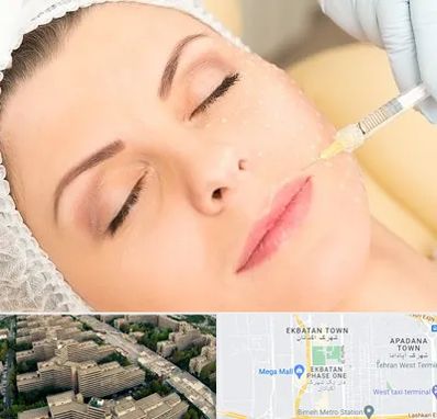 کلینیک تزریق چربی در اکباتان