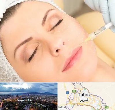 کلینیک تزریق چربی در تبریز