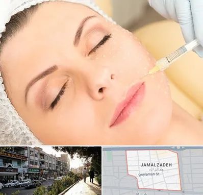 کلینیک تزریق چربی در خیابان جمالزاده