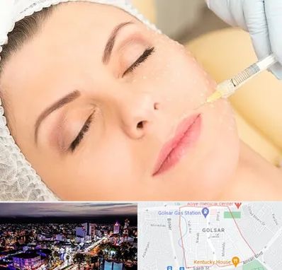 کلینیک تزریق چربی در گلسار رشت