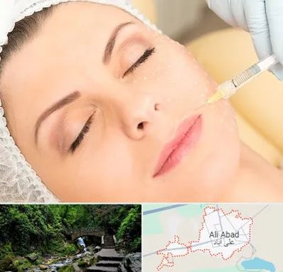 کلینیک تزریق چربی در علی‌ آباد کتول