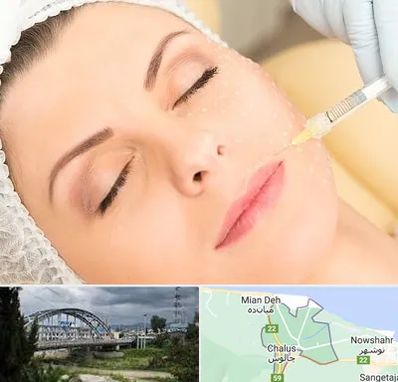 کلینیک تزریق چربی در چالوس