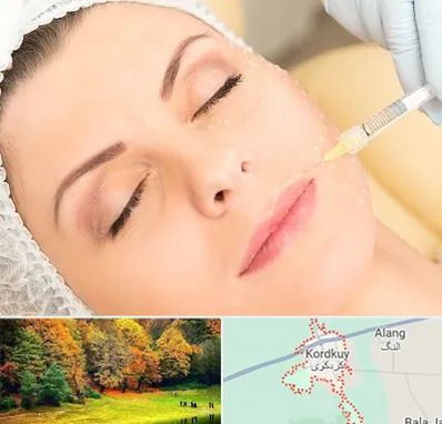 کلینیک تزریق چربی در کردکوی