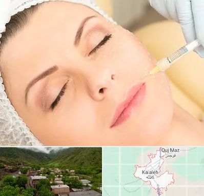 کلینیک تزریق چربی در کلاله