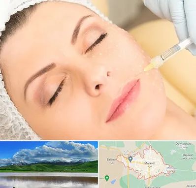 کلینیک تزریق چربی در مرند