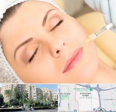 کلینیک تزریق چربی در آپادانا