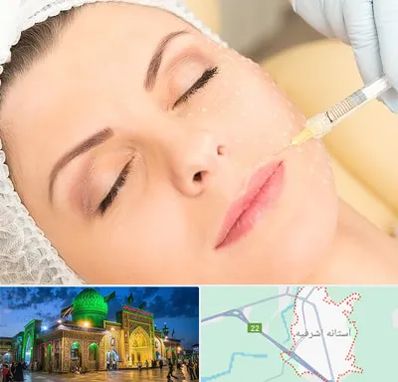 کلینیک تزریق چربی در آستانه اشرفیه