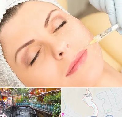 کلینیک تزریق چربی در درکه