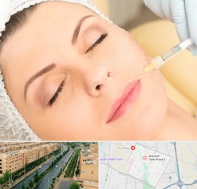 کلینیک تزریق چربی در فاز سه اندیشه
