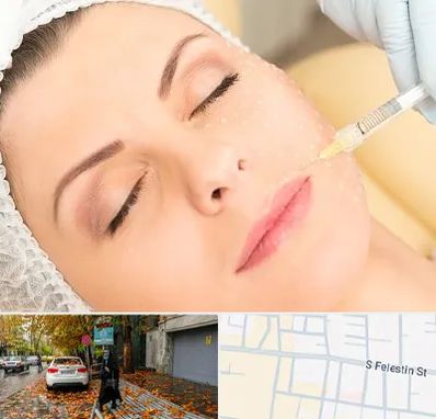 کلینیک تزریق چربی در خیابان فلسطین