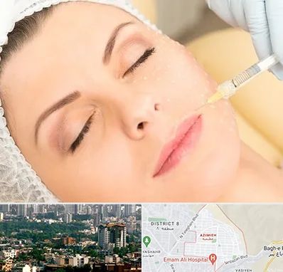 کلینیک تزریق چربی در عظیمیه کرج