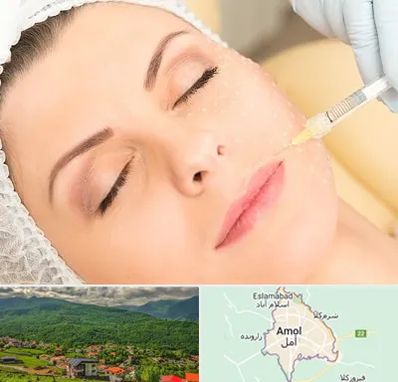 کلینیک تزریق چربی در آمل