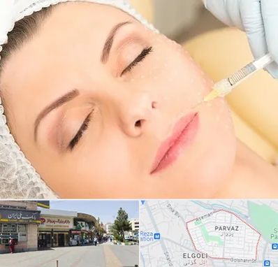 کلینیک تزریق چربی در پرواز تبریز