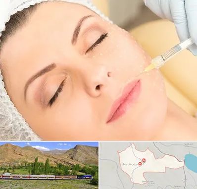 کلینیک تزریق چربی در خاش