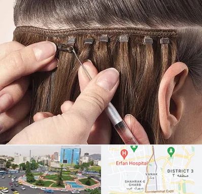 فروشگاه تجهیزات اکستنشن در ونک 