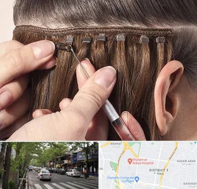 فروشگاه تجهیزات اکستنشن در ظفر 