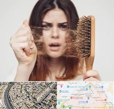 دکتر ریزش مو در شهرک غرب مشهد