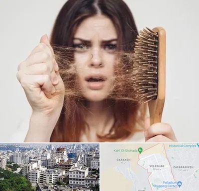 دکتر ریزش مو در ولنجک 