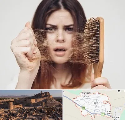 دکتر ریزش مو در بم