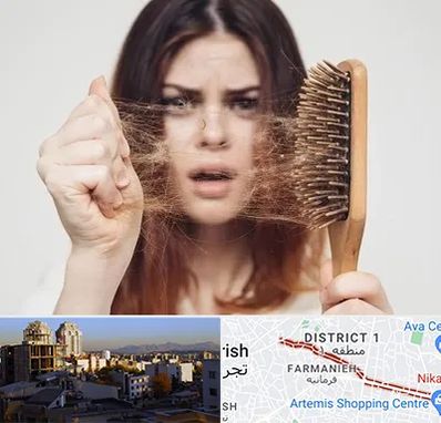 دکتر ریزش مو در فرمانیه 