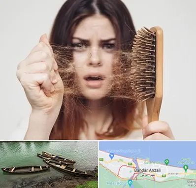 دکتر ریزش مو در بندر انزلی
