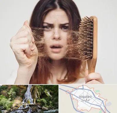 دکتر ریزش مو در الیگودرز