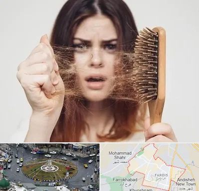 دکتر ریزش مو در فردیس کرج 