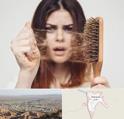 دکتر ریزش مو در اسفراین