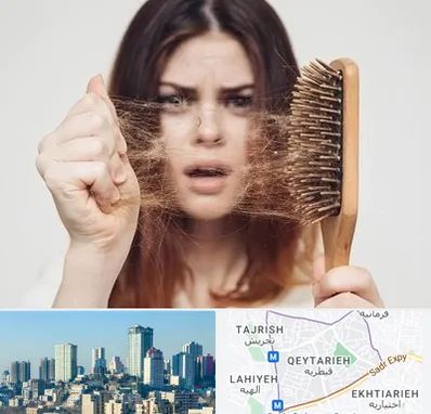 دکتر ریزش مو در قیطریه 