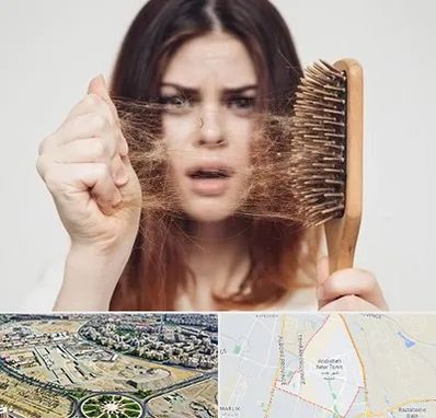 دکتر ریزش مو در اندیشه