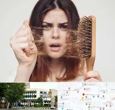 دکتر ریزش مو در طالقانی 