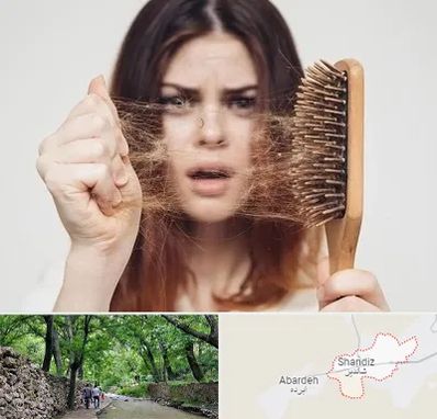 دکتر ریزش مو در شاندیز مشهد