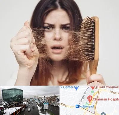 دکتر ریزش مو در اقدسیه 