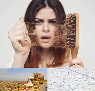 دکتر ریزش مو در هاشمیه مشهد