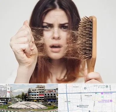 دکتر ریزش مو در مرکز تهران