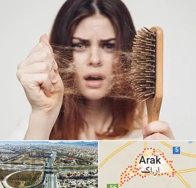 دکتر ریزش مو در اراک