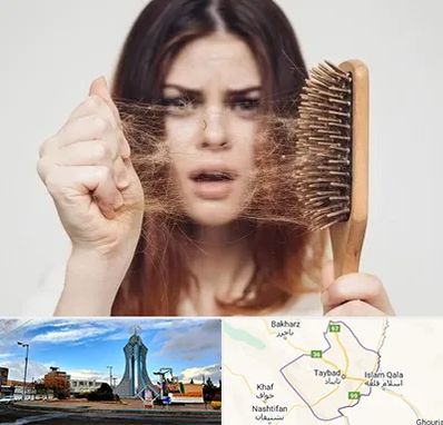 دکتر ریزش مو در تایباد