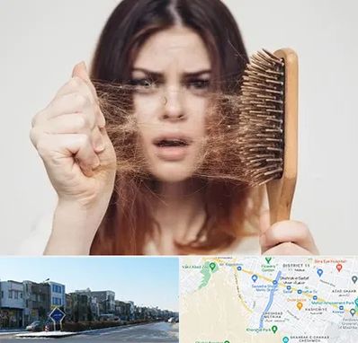 دکتر ریزش مو در شریعتی مشهد