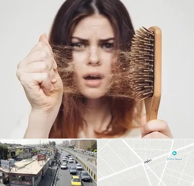 دکتر ریزش مو در خیابان دماوند