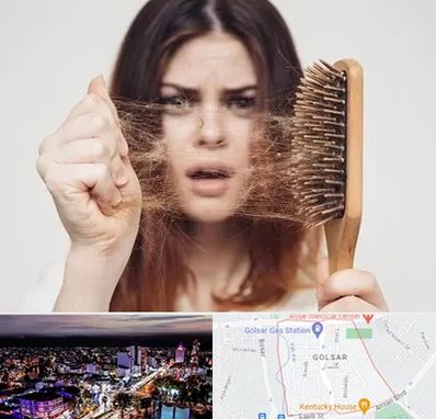 دکتر ریزش مو در گلسار رشت 