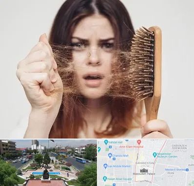 دکتر ریزش مو در بهارستان 