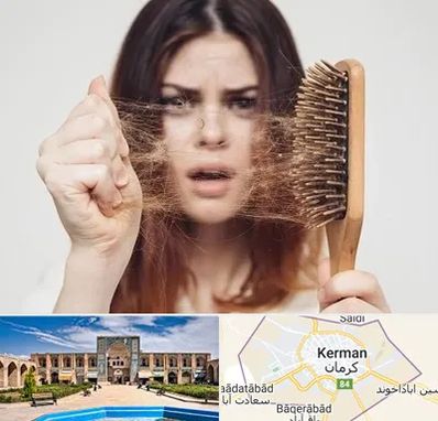دکتر ریزش مو در کرمان