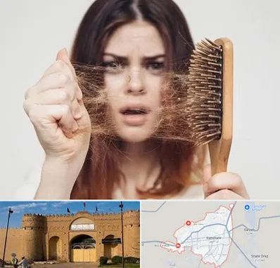 دکتر ریزش مو در ایرانشهر