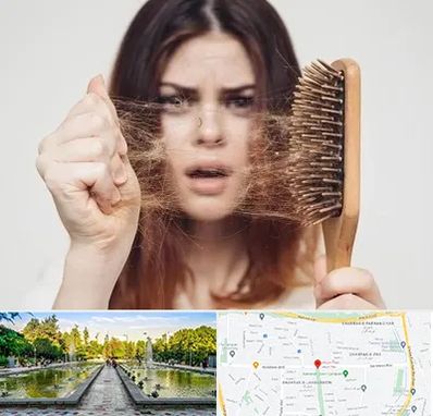 دکتر ریزش مو در سرسبز 