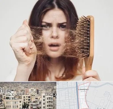 دکتر ریزش مو در اسکندری