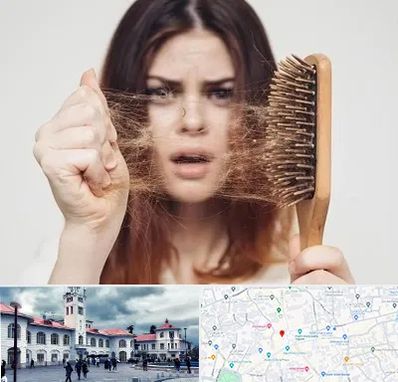 دکتر ریزش مو در میدان شهرداری رشت