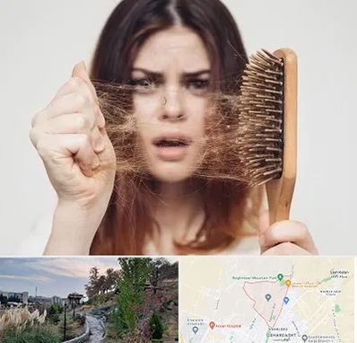 دکتر ریزش مو در باغستان کرج